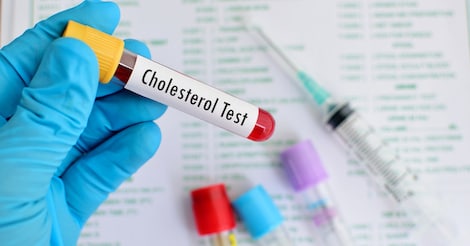 Getting to know the Cholesterol family