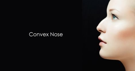 Convex-Nose Convex-Nose