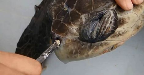 Removing a plastic straw from a sea turtle's nostril