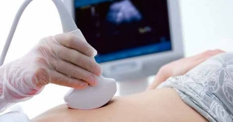 pregnancy-scan