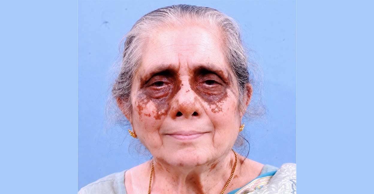 മലയാളി വയോധിക അയർലൻഡിൽ അന്തരിച്ചു