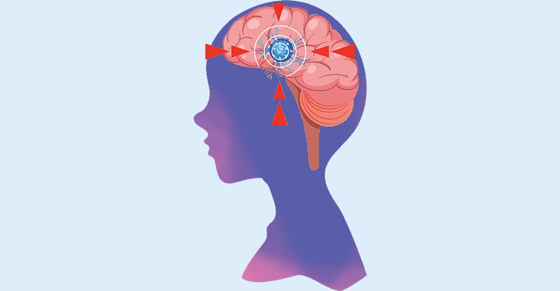 Kerala sees alarming rise in amoebic brain infections News Minimalist