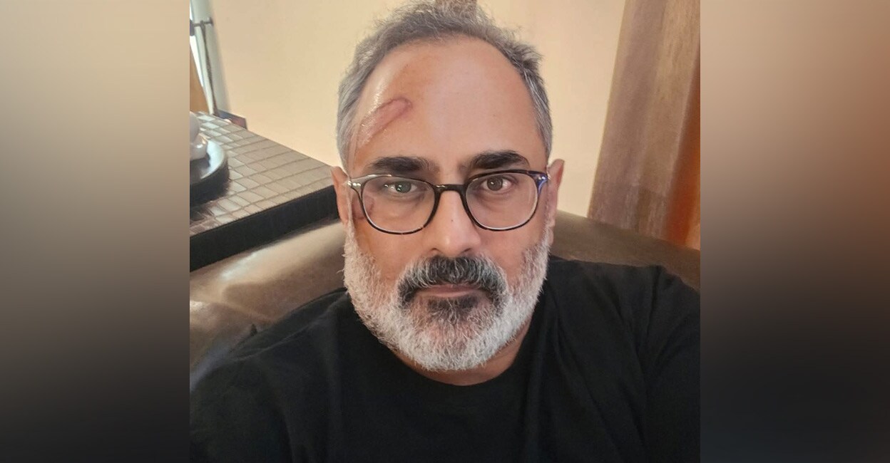 BJP州大統領ラジブ・チャンドラシーハラは、トレッドミルのBJPリーダーであるRadev Chandracekharで負傷したトレッドミルで負傷しました