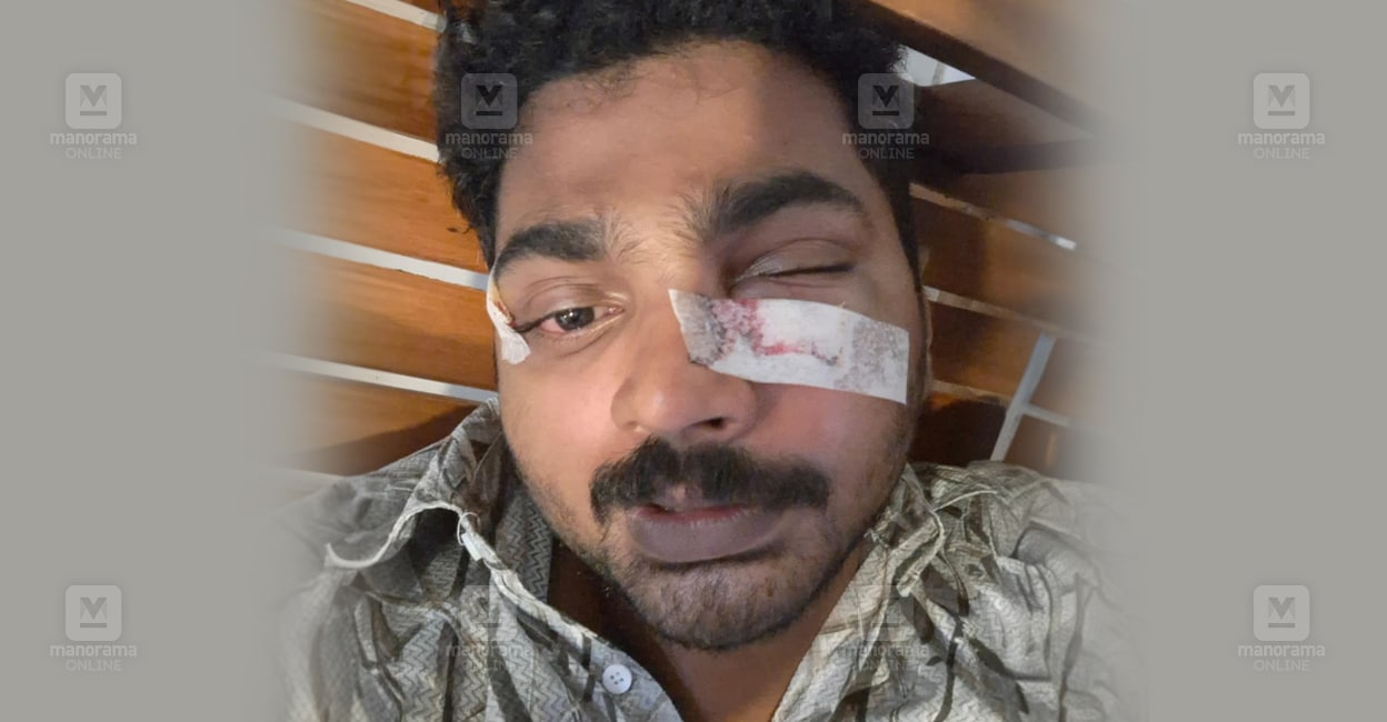 എറണാകുളത്തേക്ക് വന്ന ബസിൽ എസിയുടെ തണുപ്പു പോരാ; പുലർച്ചെ ഒന്നരയ്ക്ക് ക്ലീനറെ മർദിച്ച് യാത്രക്കാർ