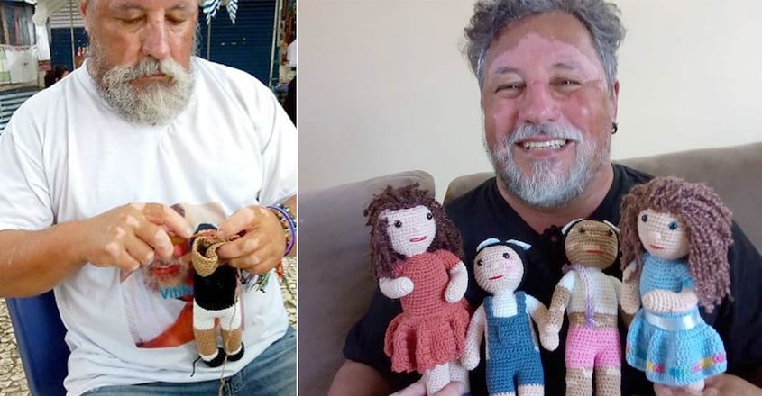 vitiligo-grandfather-knits-dolls-to-make-children-with-this-condition-feel-better1 vitiligo-grandfather-knits-dolls-to-make-children-with-this-condition-feel-better1