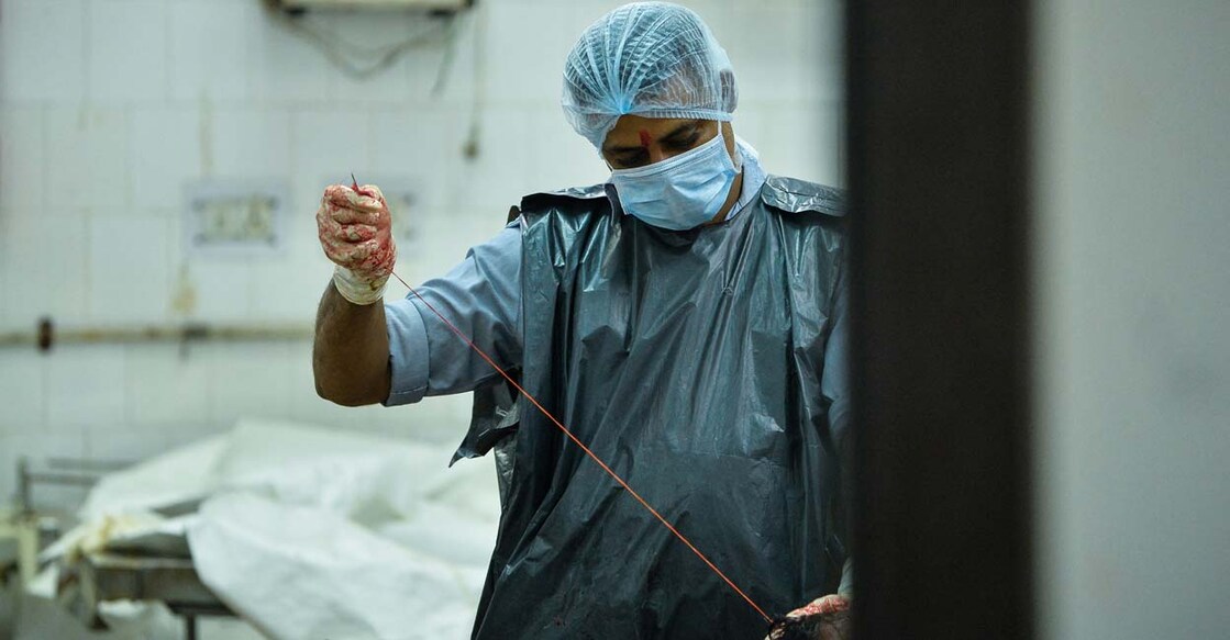 In this photograph taken on November 4, 2015, an Indian medic applies stiches to a body during a postmortem examination at a morgue in New Delhi. A rusted carving knife and a mallet lie on a steel table, while inside the cold storage rooms, bodies take up every square inch of the blood-stained floors. More than 2,500 autopsies are carried out every year at New Delhi's oldest and busiest morgue, but the air purifiers have long been broken and disinfectant supplies for washing floors ran out two months ago. AFP PHOTO / CHANDAN KHANNA (Photo by Chandan Khanna / AFP)