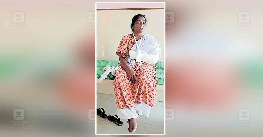 കൈക്ക് പരുക്കേറ്റ് ചേർത്തലയിലെ സ്വകാര്യാശുപത്രിയിൽ 
ചികിത്സതേടിയ തുറവൂർ പഞ്ചായത്ത് പ്രസിഡന്റ് മോളി രാജേന്ദ്രൻ  