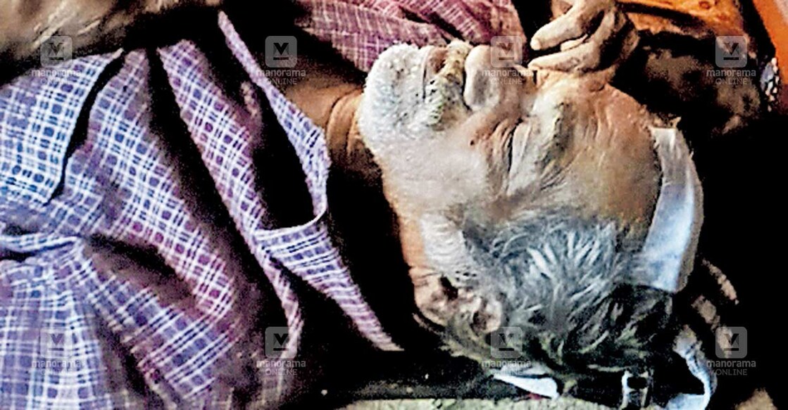 kozhikode-monkey-attack കൂരാച്ചുണ്ട് പഞ്ചായത്തിലെ താന്നിയാംകുന്നിൽ കുരുങ്ങുകൂട്ടത്തിന്റെ ആക്രമണത്തിൽ വീണ് തലയ്ക്ക് പരുക്കേറ്റ പാലാഞ്ചേരി ദാമോദരൻ നമ്പ്യാർ