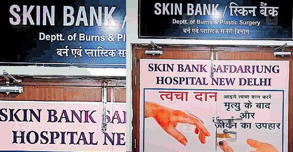 skin-bank-safdarjung-hospital-delhi