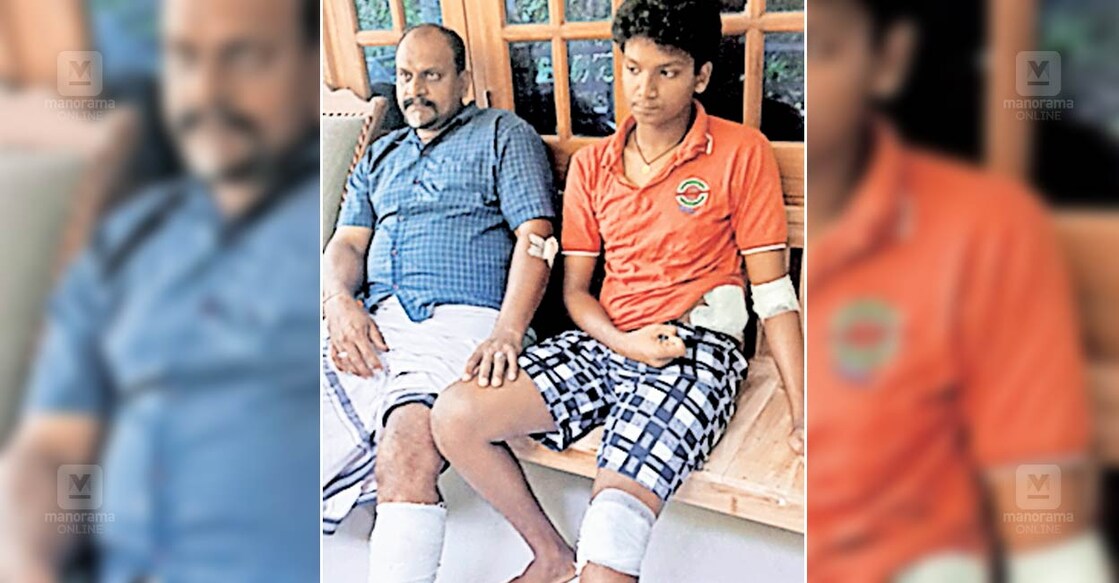 ns7-elavumthitta-wild-boar-attack മെഴുവേലിയിൽ കാട്ടുപന്നിയുടെ ആക്രമണത്തിൽ പരുക്കേറ്റ ഉണ്ണി, മകൻ കാശിനാഥൻ.