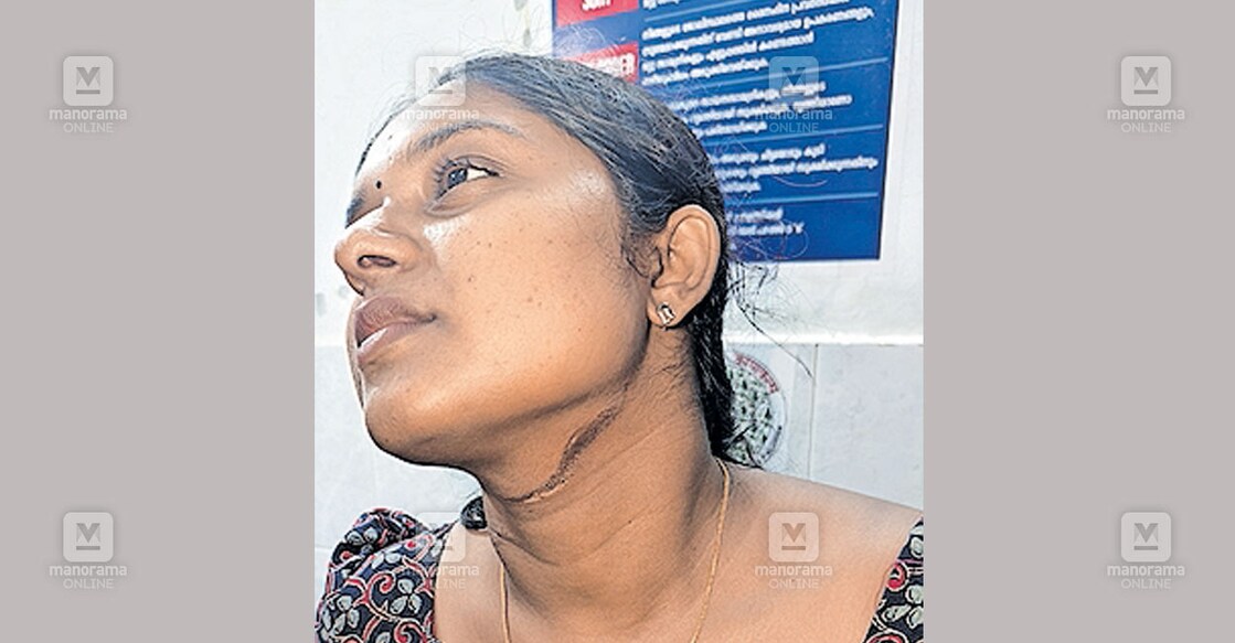 അപകടത്തിൽപെട്ട അനുപമ.  