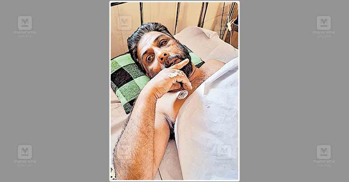 പരുക്കേറ്റ ജോർജ‌് കൊളഗപ്പാറയിലെ വീട്ടിൽ.  
