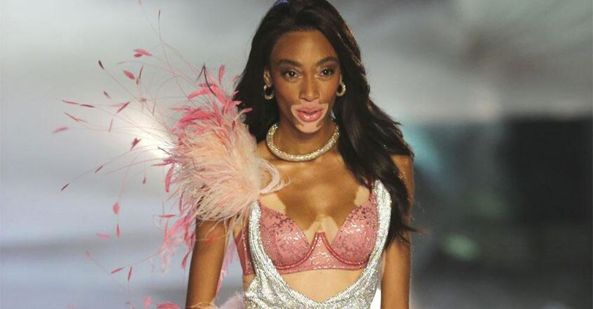winnie-harlow2 winnie-harlow2