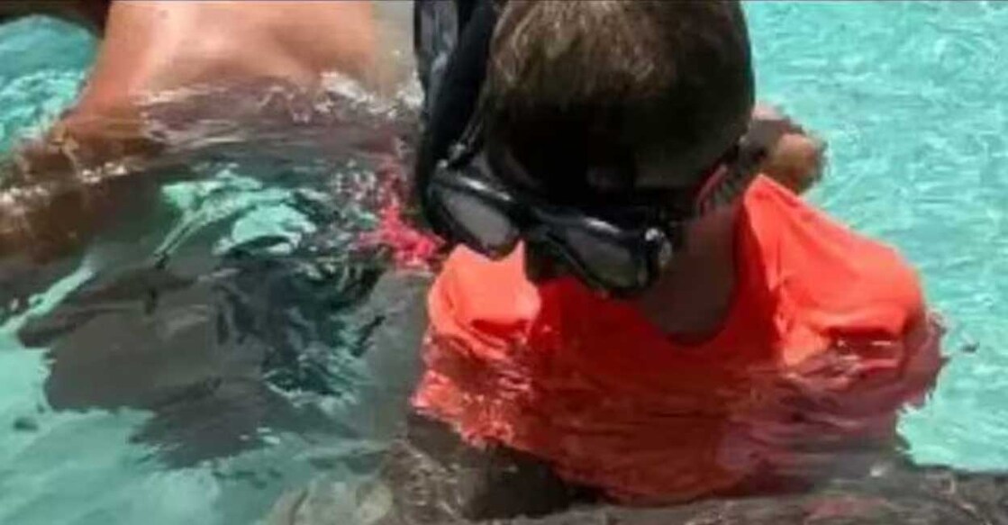 sharkattack സ്രാവിന്റെ ആക്രമണത്തിനിരയായ കുട്ടി (Photo: X/tmz)