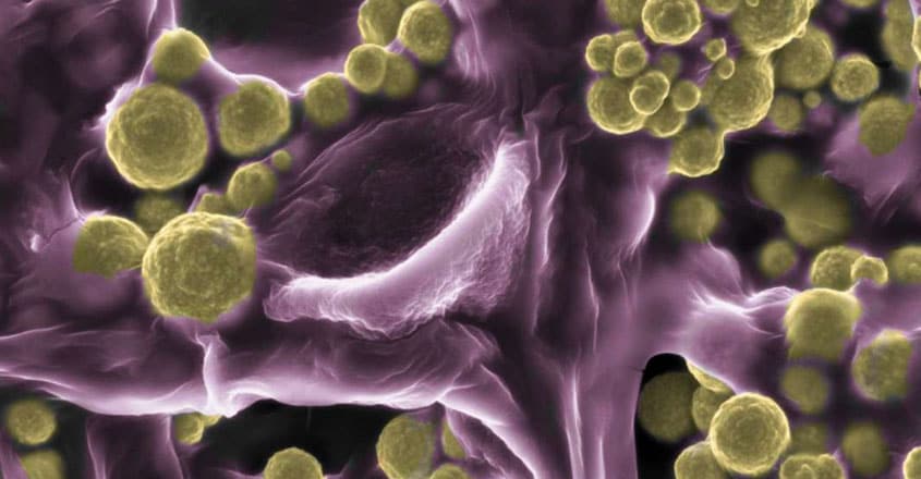 Meet The Fungus That Mines And Wears Gold Meet The Fungus That Mines And Wears Gold