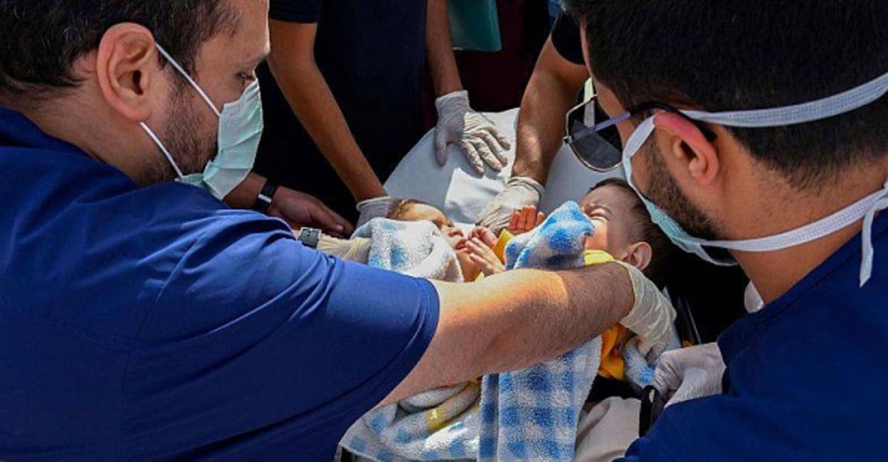 “Riyadh Hospital Performs Separation Surgery on Syrian Conjoined Twins”