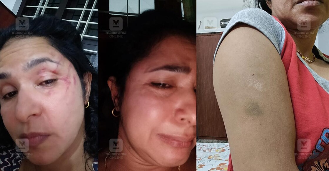wife-brutally-tortured-as-husband-fall-in-love-with-another-woman-dubai-case-registered