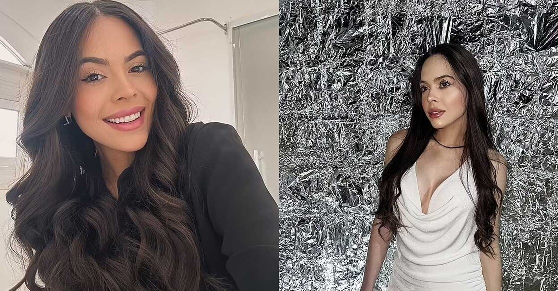 fashion-influencer-dies-at-28-from-septic-shock Image Credit: Instagram/laleskalexandre