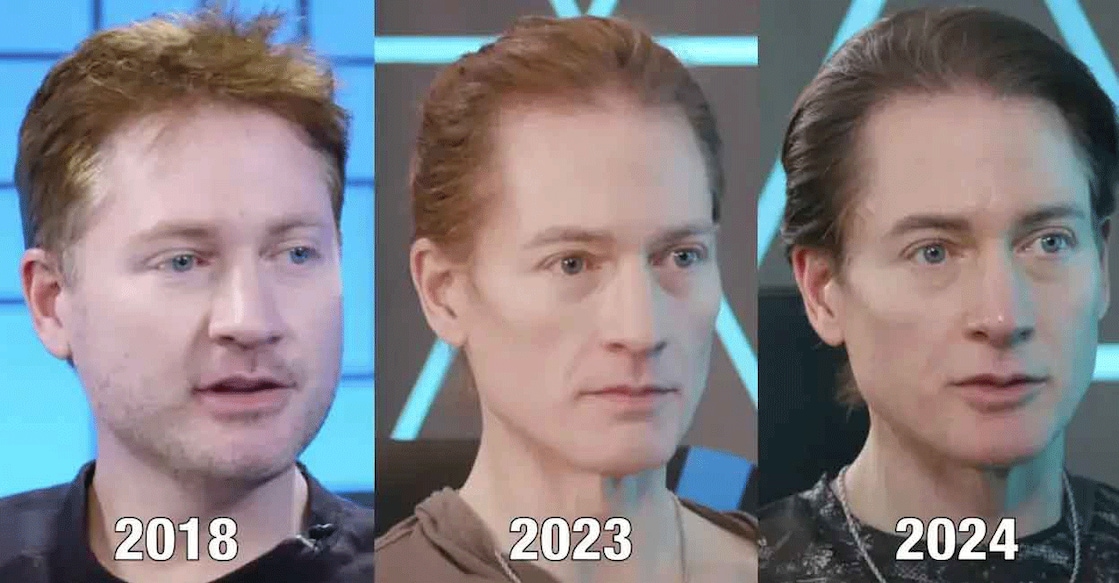 bryan-johnson-shares-pics-of-his-age-reversing-transformation ബ്രയാൻ ജോൺസൺ.
