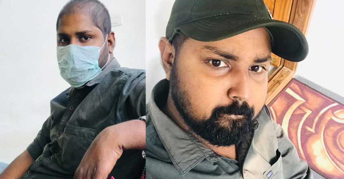 sivakumar-cancer survivor sivakumar-cancer survivor
