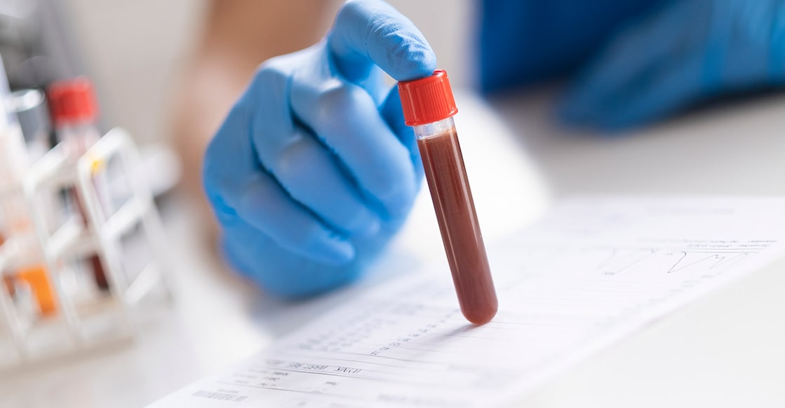 hemoglobin Photo Credit: Foremniakowski/ Istockphoto