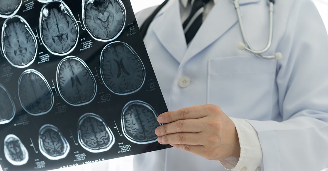 stroke-ct-scan-image-create-jobs-51-shutterstock-com