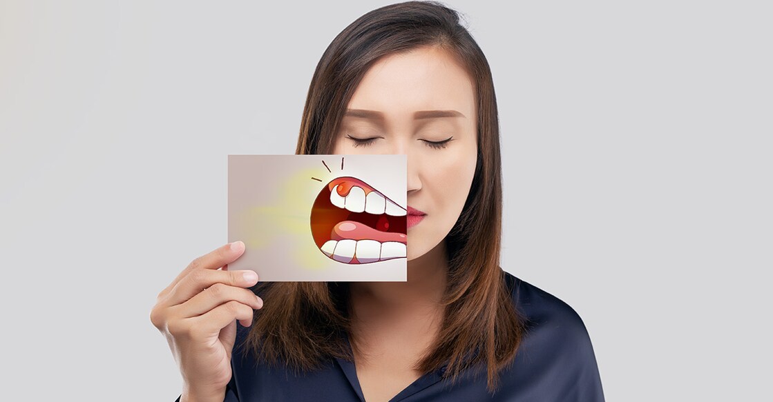 oral cancer Photo Credit: Emily frost/ Shutterstock.com