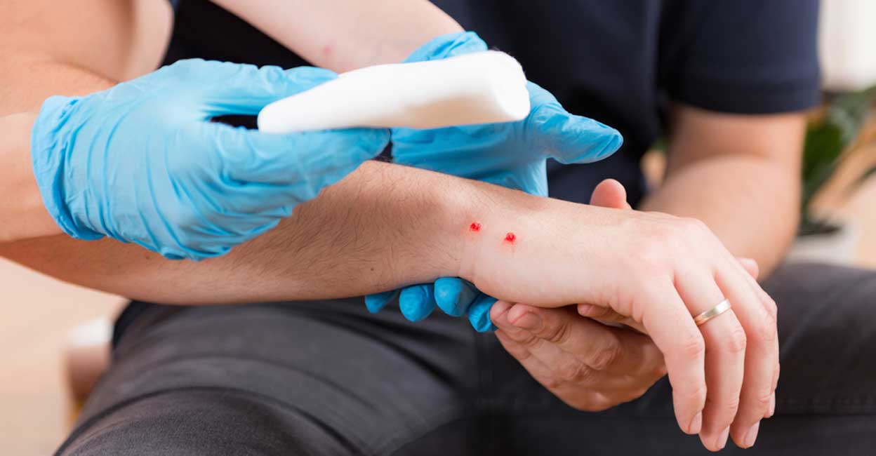 first-aid-snake-bite-tooth-mark-microgen-shutterstock-com first-aid-snake-bite-tooth-mark-microgen-shutterstock-com