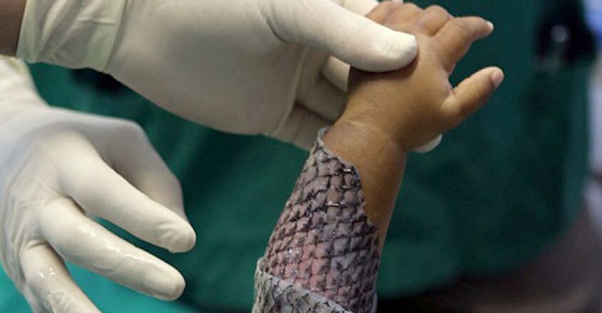 tilapia-skin-1 tilapia-skin-1