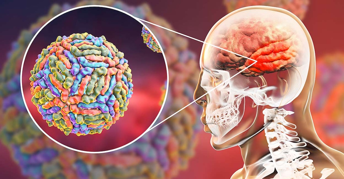 west-nile-fever Image credit: Kateryna Kon/ShutterStock