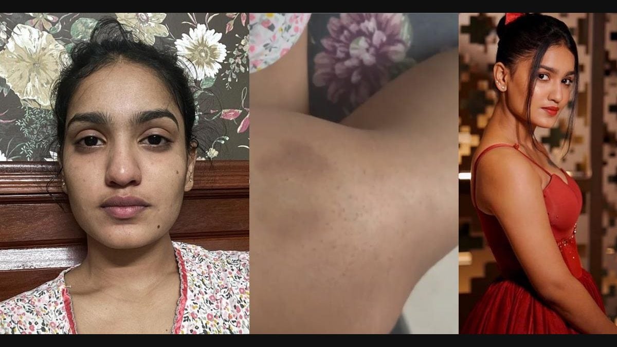കോവിഡ് നിസാരമല്ല: നടുക്കുന്ന ഓർമകളുമായി സാനിയ ഇയ്യപ്പൻ; വിഡിയോ | Saniya  Iyyappan Covid
