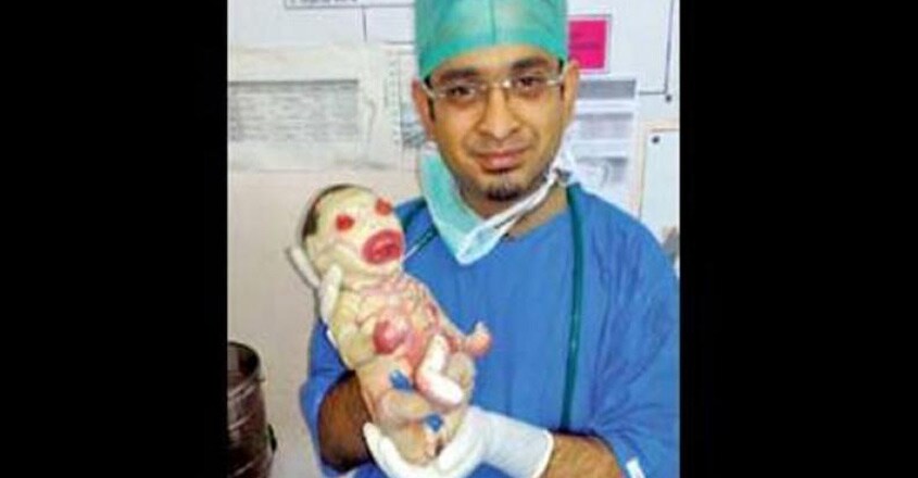 nagpur-baby nagpur-baby
