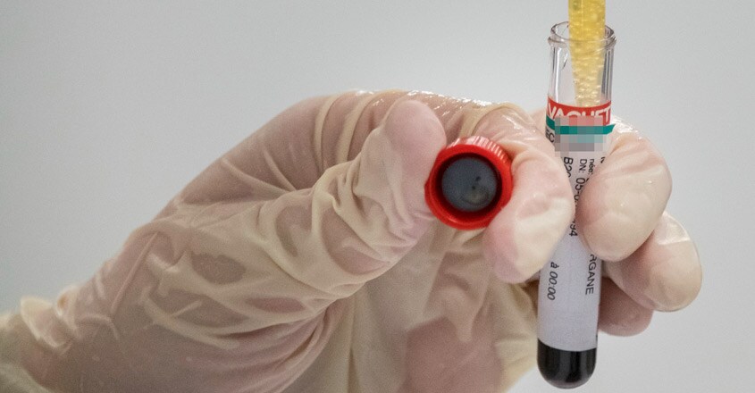 FRANCE-HEALTH-VIRUS-TEST FRANCE-HEALTH-VIRUS-TEST
