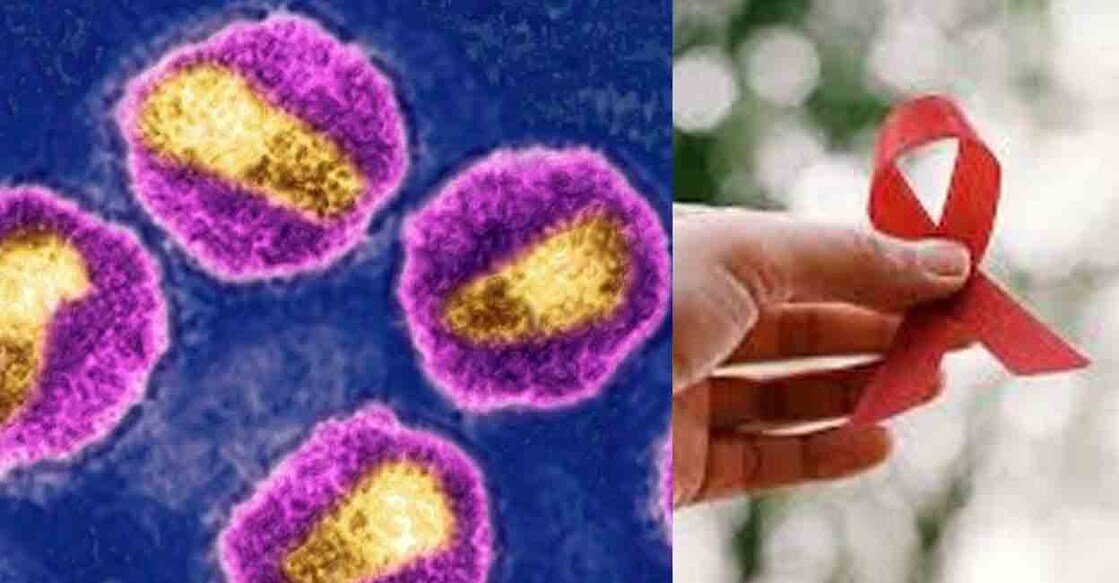 Hiv-New-Variant-1248