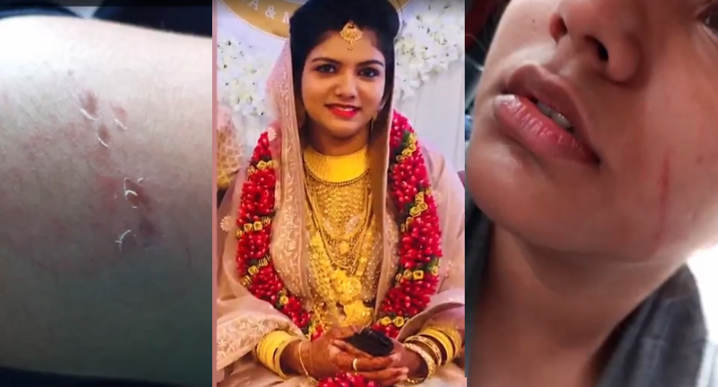 തിരുവല്ലത്ത് യുവതി ജീവനൊടുക്കി; ഭർത്താവിന്റെയും ഭർതൃമാതാവിന്റെയും പീഡനം മൂലമെന്ന് പരാതി, മർദന ദൃശ്യങ്ങൾ പുറത്ത്