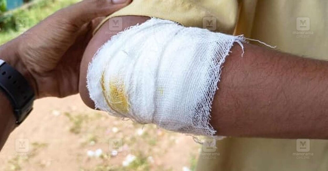 കുമരനെല്ലൂർ ഗവൺമെന്റ് ഹയർ സെക്കൻഡറി സ്കൂളിൽ വിദ്യാർഥികൾ തമ്മിലുണ്ടായ സംഘർഷത്തിൽ പരുക്കേറ്റ വിദ്യാർഥി.