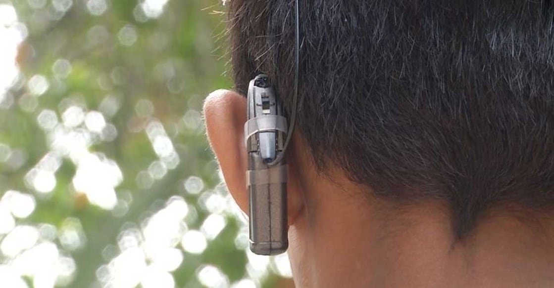 cochlear ഫയൽചിത്രം.