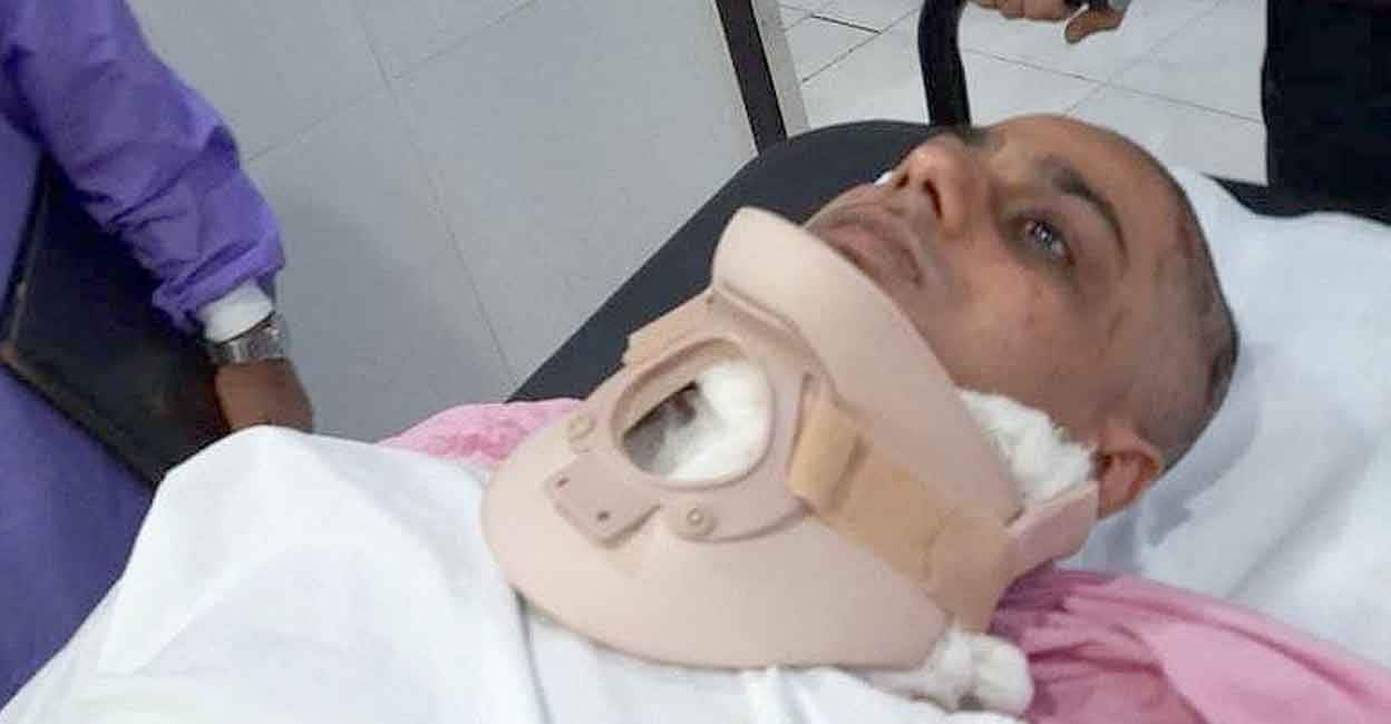 Bollywood Casting Director Mayank Dixit Brutally Attacked in New Delhi: Sustains Head and Neck Injuries