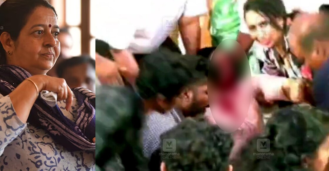 Blood clots in the lungs, head and spinal cord injuries; Uma Thomas on ventilator | Manorama Online News – Kaloor Stadium Accident: Uma Thomas Suffers Injuries – Manorama Online | Malayalam News | Manorama News