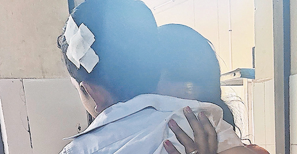 സ്കൂളിലേക്കുള്ള വഴിയിൽ അഞ്ചു വയസ്സുകാരനെ കാട്ടുപന്നി ആക്രമിച്ചു