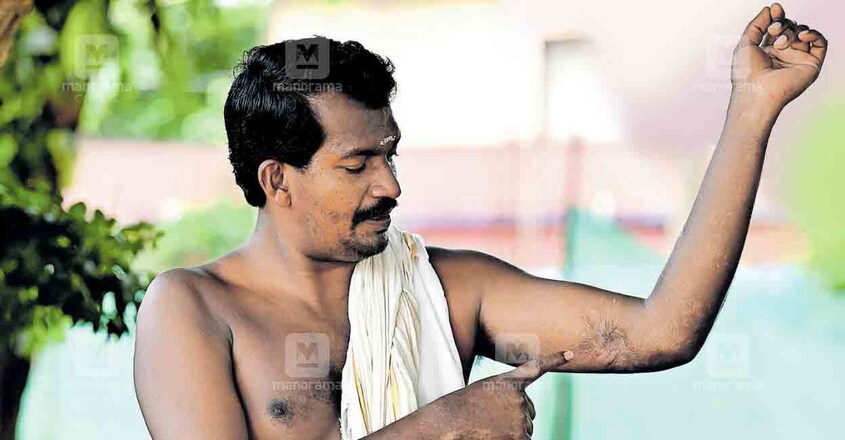 puttingal-fire-accident-kannan puttingal-fire-accident-kannan