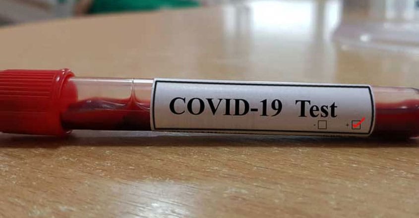 Kovid 19 Test Kovid 19 Test