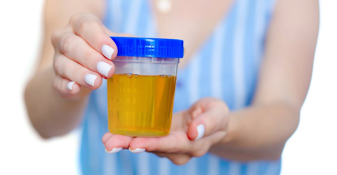 Urine-Sample Urine-Sample