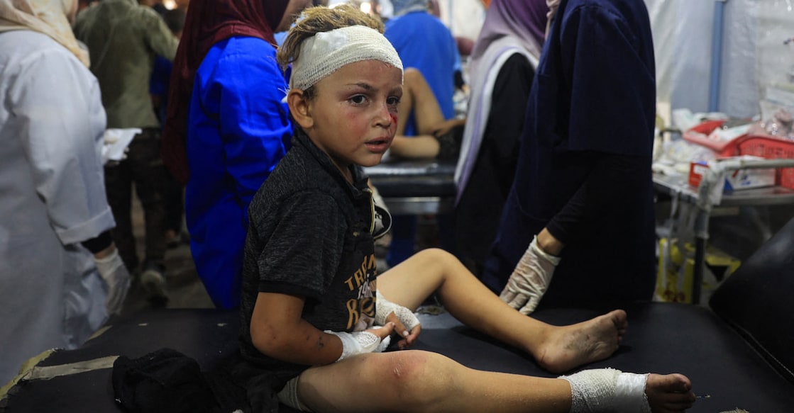 PALESTINIAN-ISRAEL-CONFLICT ഇസ്രയേലിന്റെ ആക്രമണത്തിൽ ഗുരുതരമായി പരുക്കേറ്റ പലസ്തീൻ ബാലൻ. (Photo by Eyad BABA / AFP)