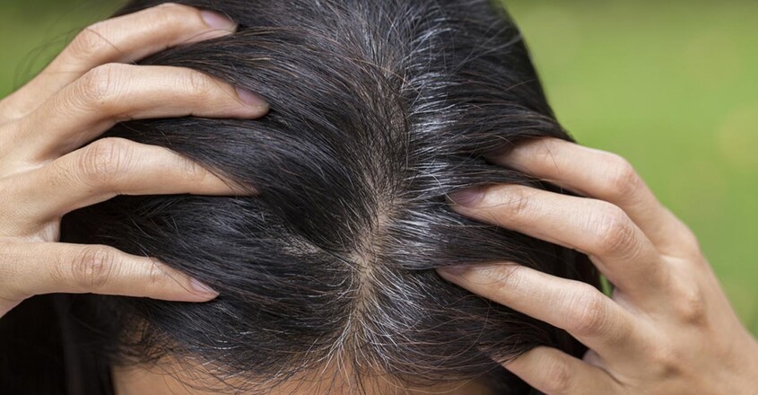 the-best-way-to-prevent-greying-and-loss-of-hair