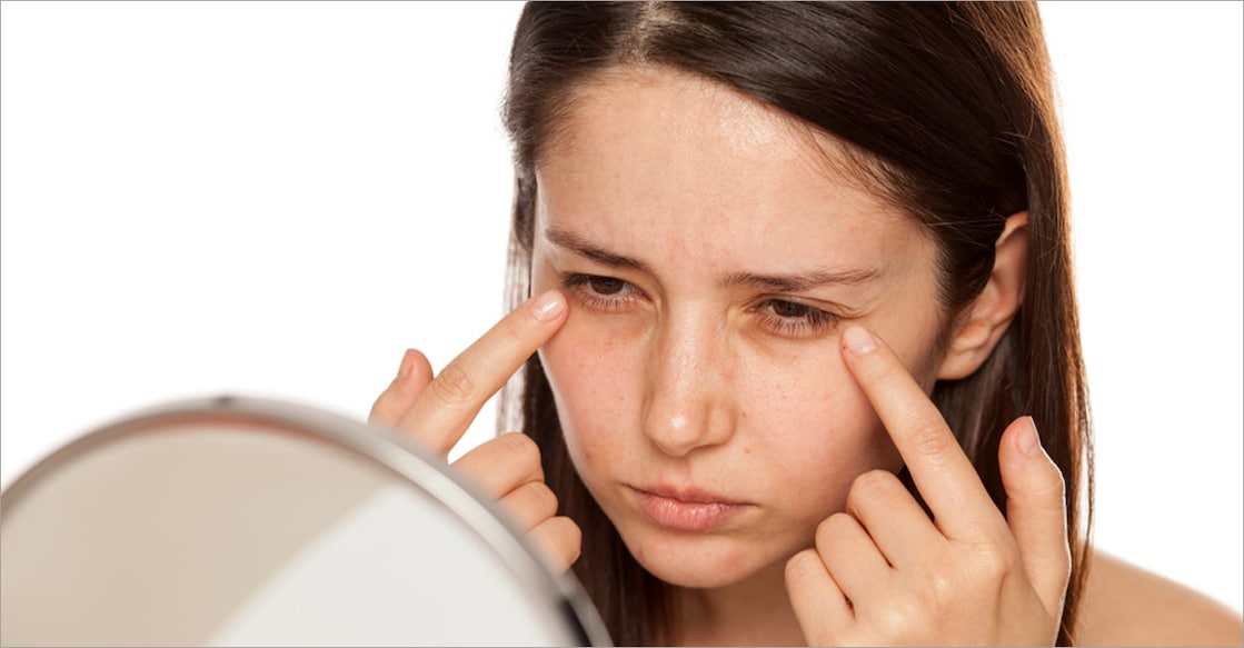 tips-to-avoid-dark-circles-under-eyes Image Credits : Vladimir Gjorgiev / Shutterstock.com