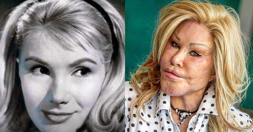 jocelyn-wildenstein-0 jocelyn-wildenstein-0