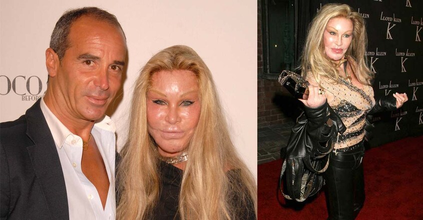 jocelyn-wildenstein-2 jocelyn-wildenstein-2