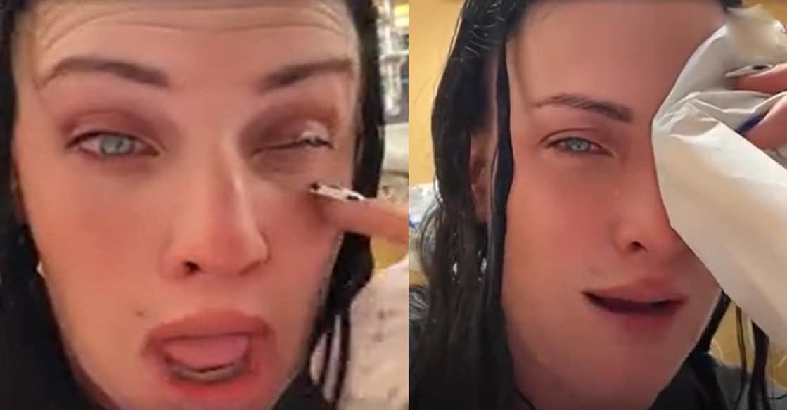 woman-ends-up-in-hospital-after-mistaking-super-glue-for-eye-drops woman-ends-up-in-hospital-after-mistaking-super-glue-for-eye-drops