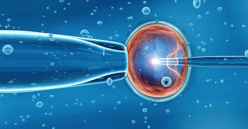 IVF IVF